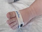 Pediatrinis pulsoksimetras - nuotraukos Nr. 3