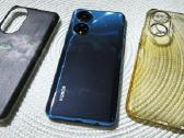 Honor x7 - nuotraukos Nr. 2