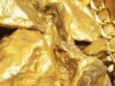 Perkame stomatologini auksa ,dantu koroneles 80€