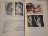 Ortopedijos ir traumatologijos vadovas - nuotraukos Nr. 6