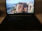 Dell Xps 15 9530 liečiamu ekranu