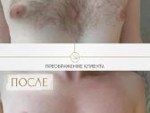 Depiliacija Vilniuje Moterims ir vyrams - nuotraukos Nr. 3