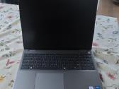 Parduodu Vostro 16 5640 Intel Core 5 120u, 16gb, 5 - nuotraukos Nr. 4