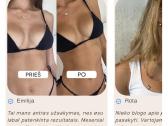 Savaiminio įdegio kapsulės