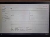 Thinkbook i5-10300h/gtx1650 - nuotraukos Nr. 11