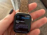 Apple watch series 11 Cellular Aluminium Rose Gold - nuotraukos Nr. 6