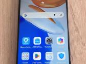 Honor X7 - nuotraukos Nr. 2