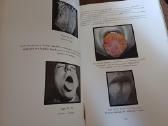 Parduodu knyga,medicinos/odontologijos atlasas1937 - nuotraukos Nr. 15