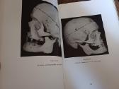Parduodu knyga,medicinos/odontologijos atlasas1937 - nuotraukos Nr. 5