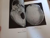 Parduodu knyga,medicinos/odontologijos atlasas1937 - nuotraukos Nr. 18