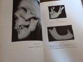 Parduodu knyga,medicinos/odontologijos atlasas1937 - nuotraukos Nr. 20