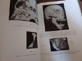 Parduodu knyga,medicinos/odontologijos atlasas1937 - nuotraukos Nr. 21