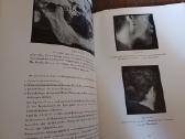 Parduodu knyga,medicinos/odontologijos atlasas1937 - nuotraukos Nr. 25