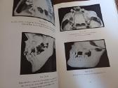 Parduodu knyga,medicinos/odontologijos atlasas1937 - nuotraukos Nr. 30