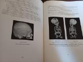 Parduodu knyga,medicinos/odontologijos atlasas1937 - nuotraukos Nr. 32