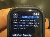 Apple Watch Series 10 (46mm) GPS + Cellular - nuotraukos Nr. 2