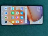 Redmi Note 12 Pro 5G - nuotraukos Nr. 3
