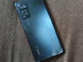 Xiaomi redmi note 11
