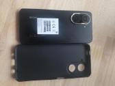 Xiaomi Redimi A5 - nuotraukos Nr. 2