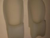 Rinkinys kojytem: halux valgus,pirstu tiesintojai. - nuotraukos Nr. 15
