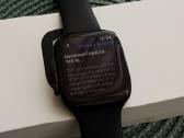 Apple Watch Series 10 46 mm GPS + Cellular - nuotraukos Nr. 3