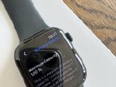 Apple Watch Series 11 (42mm, S/m) – Baterija 100% - nuotraukos Nr. 2