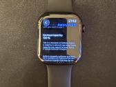 Apple Watch 11 46mm - nuotraukos Nr. 3