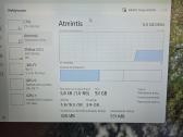 Hp Victus i5-13420h/rtx 4050/ 512gb / 16gb - nuotraukos Nr. 9