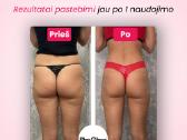 She Glow Pro anticeliulito aparatas - nuotraukos Nr. 5