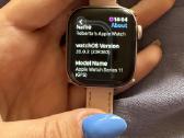 Apple watch series 11 - nuotraukos Nr. 3
