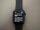 Apple Watch Se 3 40mm - nuotraukos Nr. 3