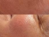 Akvile Glow Beauty Studio Grožio Paslaugos Kaune - nuotraukos Nr. 9