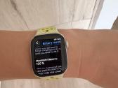 Apple Watch 11 + 1 metu garantija - nuotraukos Nr. 4