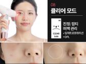 Aalok Ultra Change Focus – Baby Pink Edition - nuotraukos Nr. 9