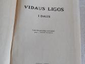 Vidaus ligos - nuotraukos Nr. 2