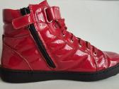 Dolce & Gabbana lakuoti aulinukai, 34 dydis - nuotraukos Nr. 2