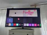 LG smart TV 65 col - nuotraukos Nr. 2
