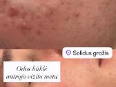 Profesionalios veido ir kūno procedūros! - nuotraukos Nr. 4