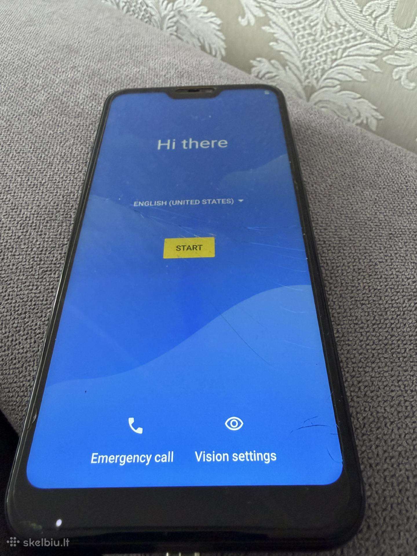 Mi A2 Lite