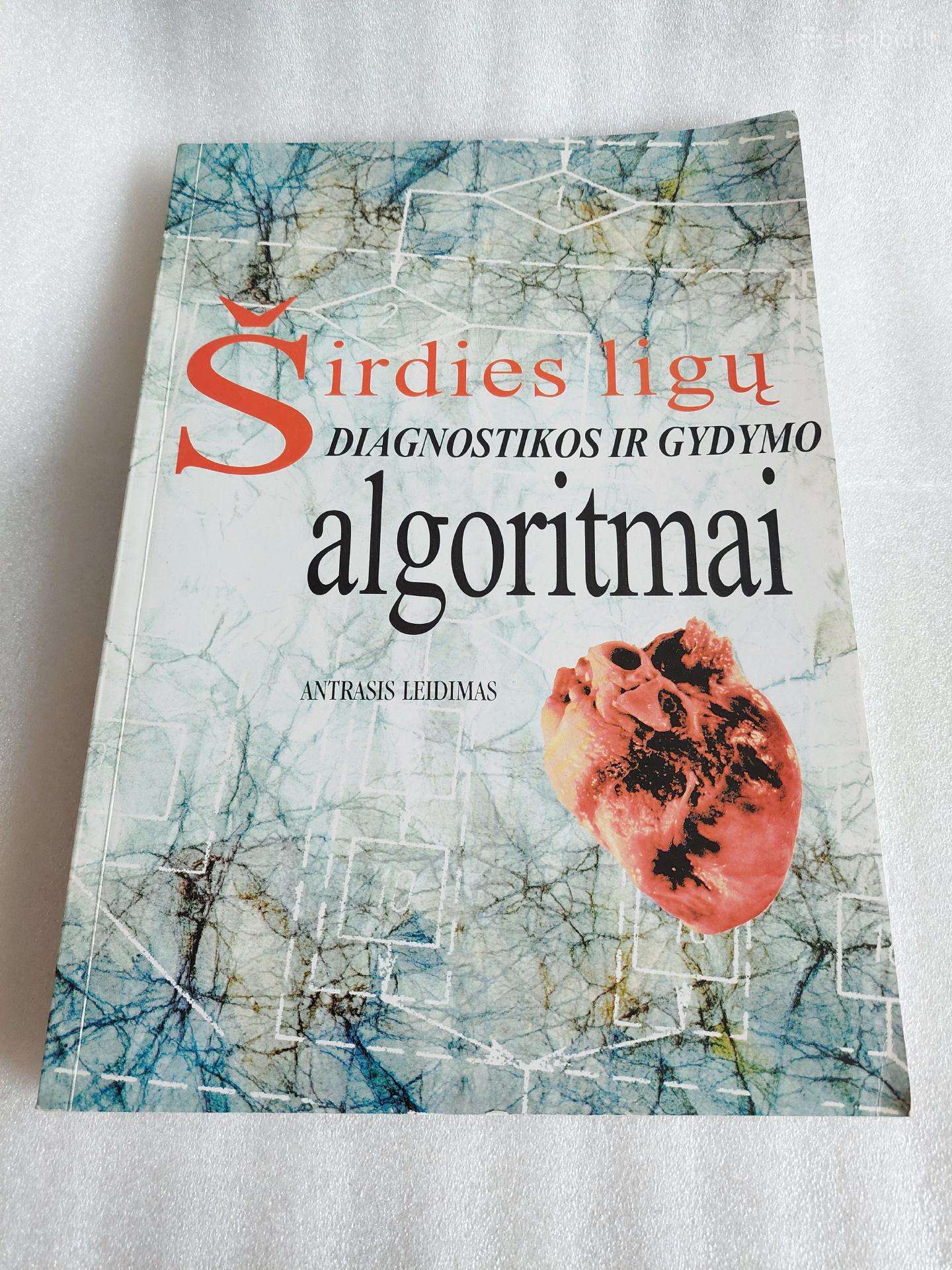 Širdies ligų diagnostikos ir gydymo algoritmai -2
