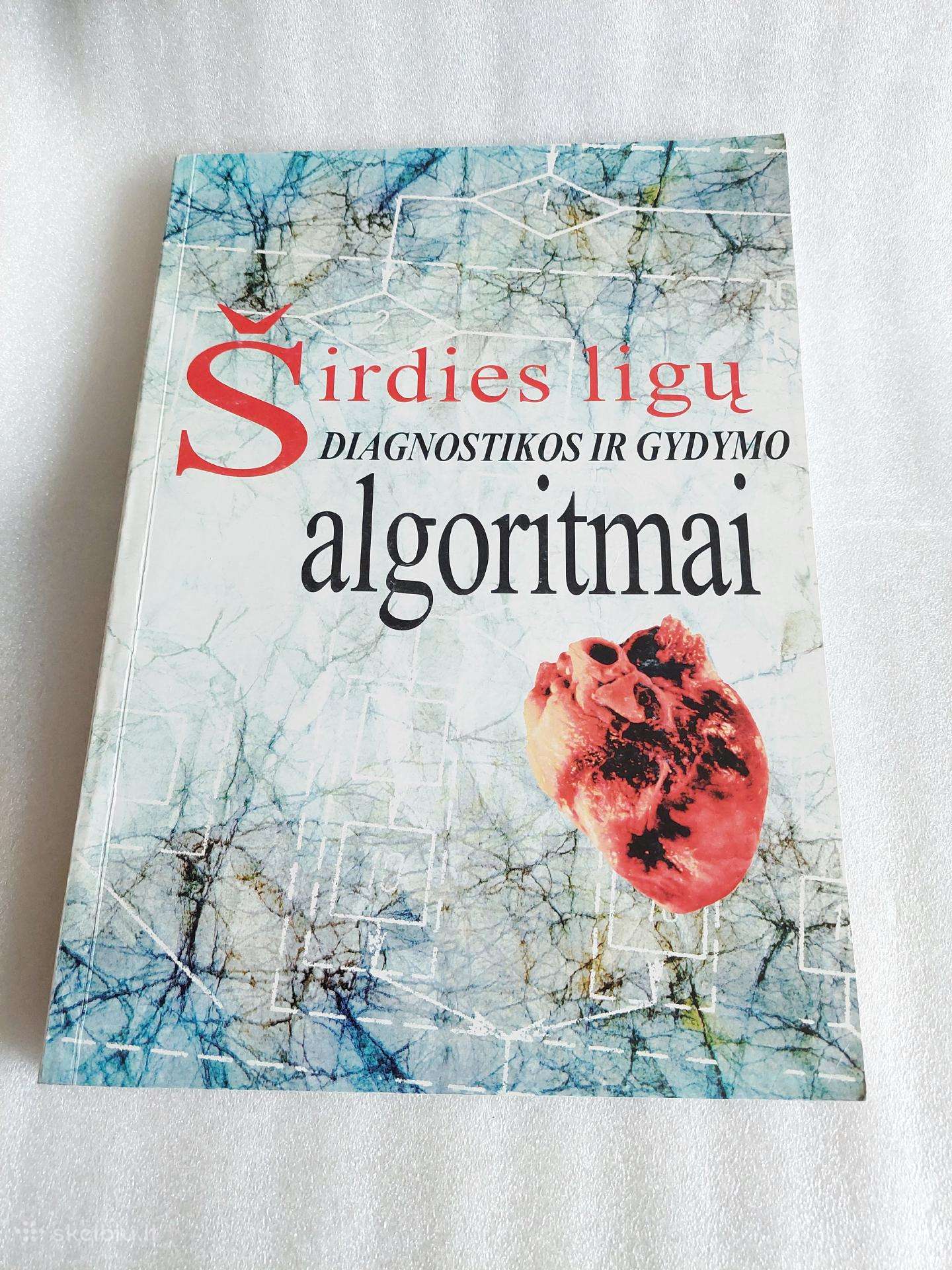 Širdies ligų diagnostikos ir gydymo algoritmai